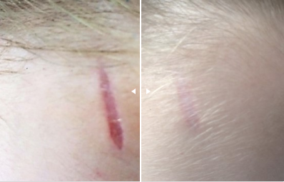 Disease Image