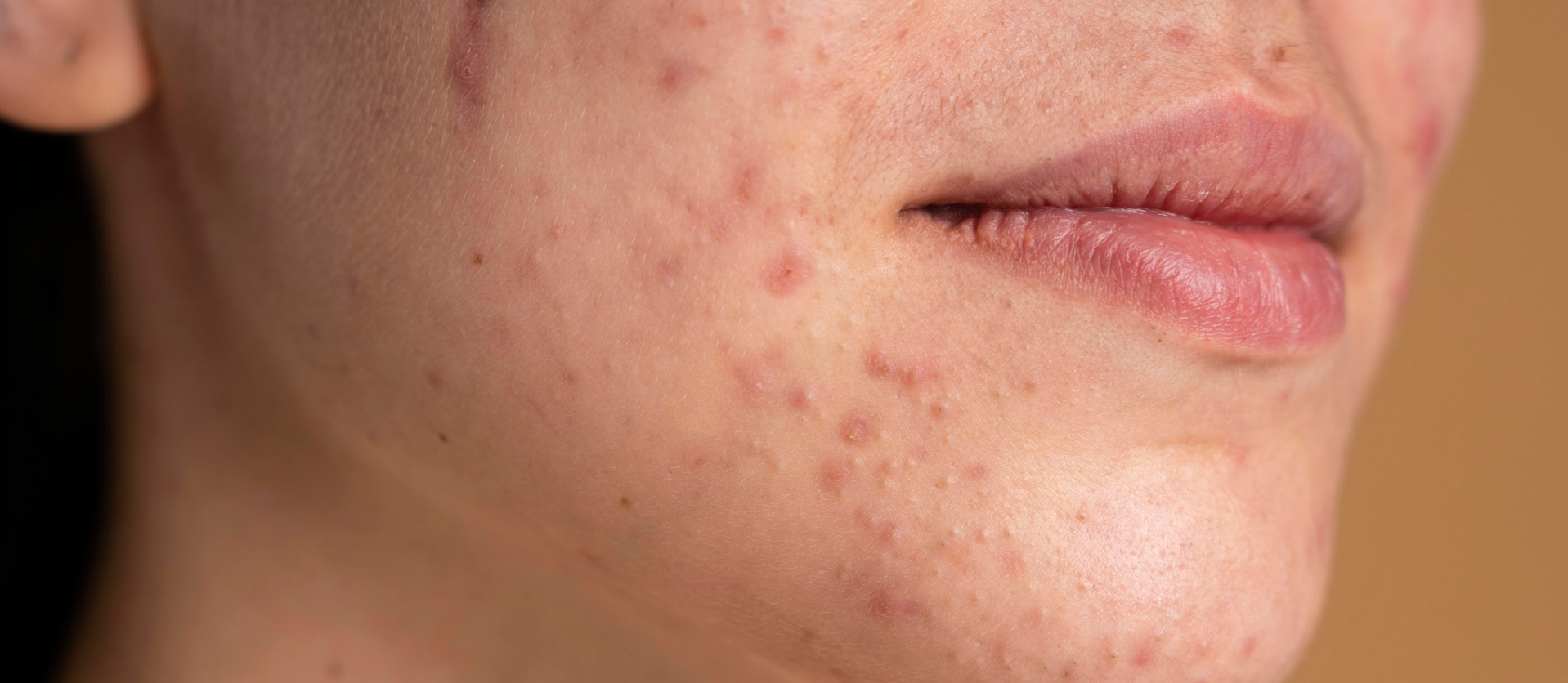 Disease Image